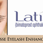 Latisse-Eyelash-Enhancement-image2